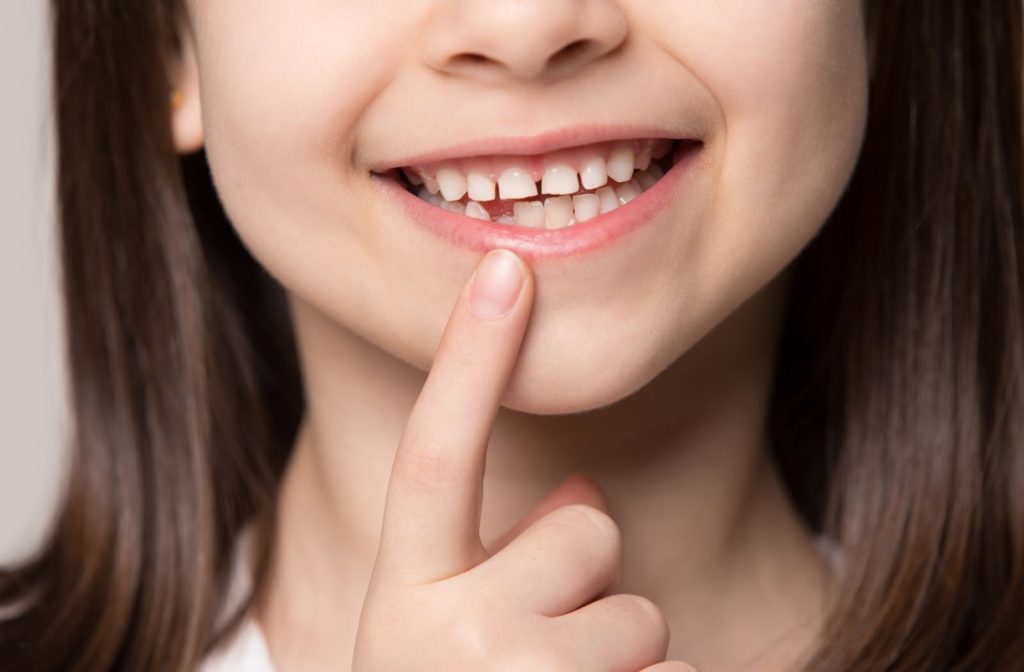 A young girl pointing at her missing baby tooth