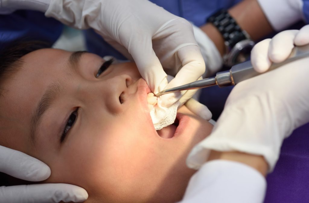 Young boy at the dentist receiving treatment for his avulsed tooth