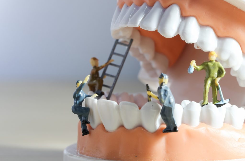 Miniature figures symbolizing a cleaning team cleaning dentures