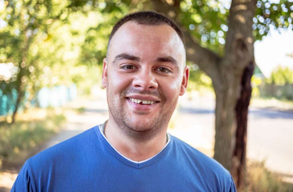 A man with a blue shirt smiling with a chipped tooth.
