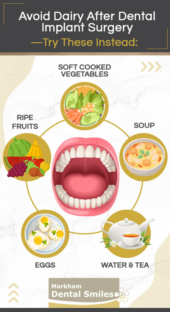 An inforgraphic with the image of an open mouth and foods to avoid after dental implant surgery circled all around.
