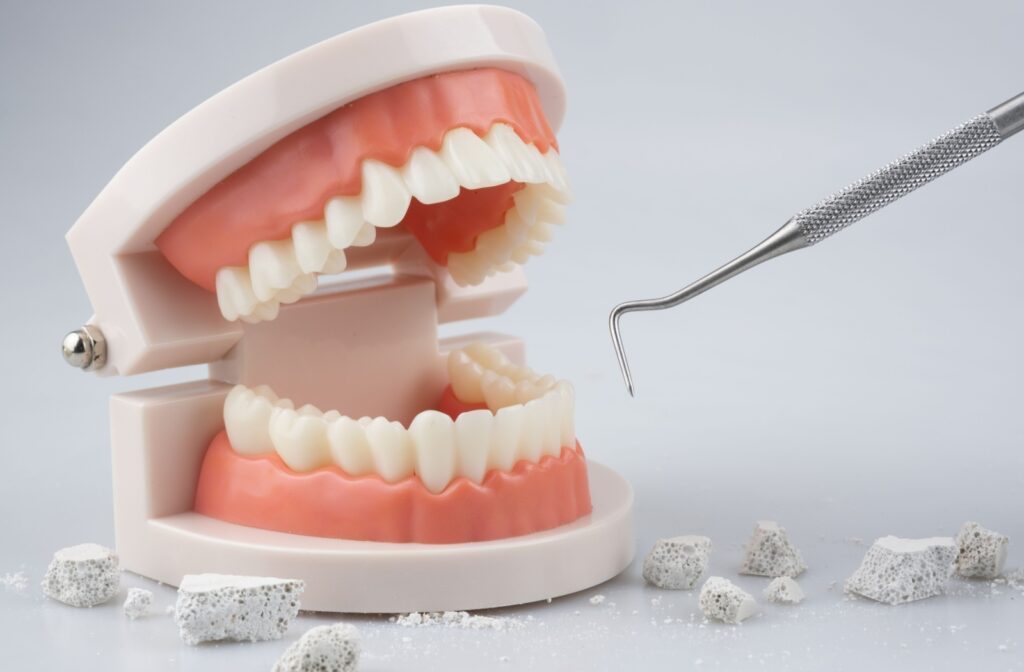 A model of teeth against a grey background and a dental scraper surrounded by crumbly rocks meant to represent tartar
