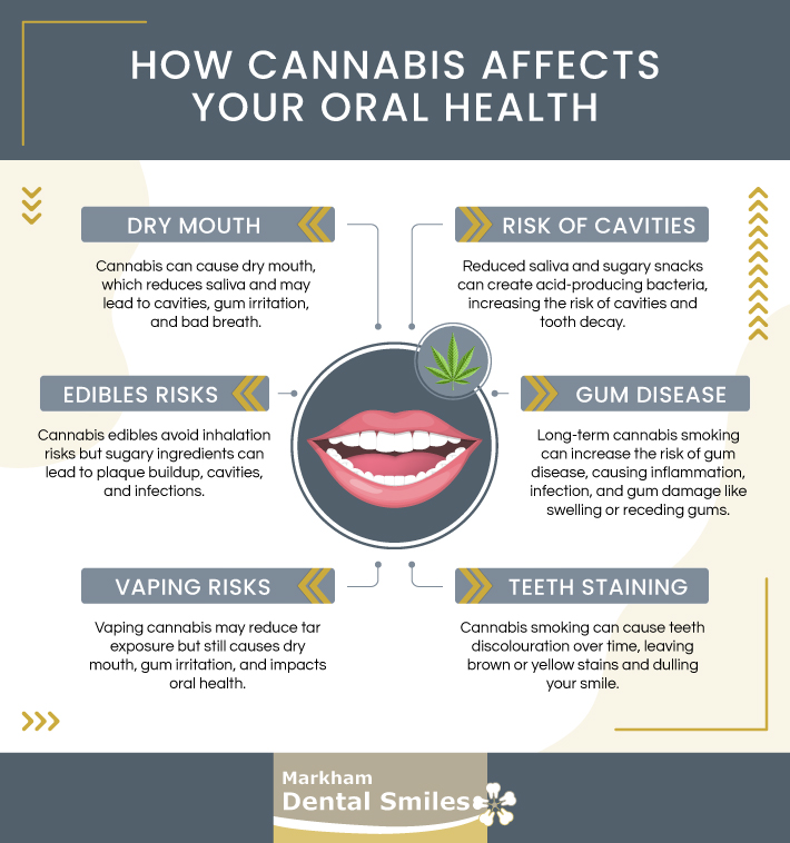 An infographic highlighting the effects of cannabis on teeth.